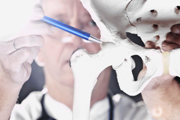 Osteoarthritis